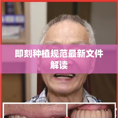 即刻种植规范最新文件解读