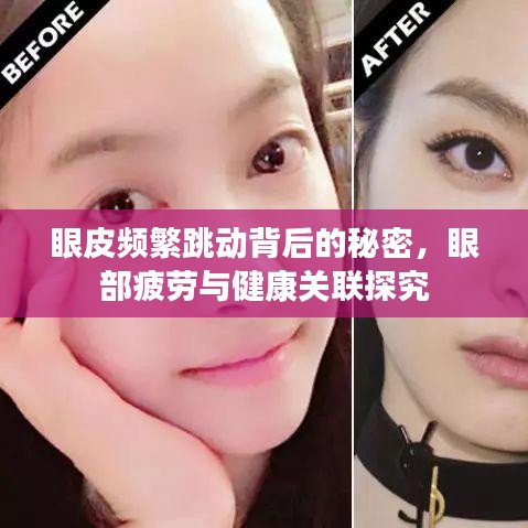 眼皮频繁跳动背后的秘密，眼部疲劳与健康关联探究