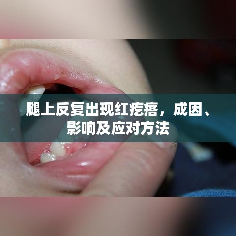 腿上反复出现红疙瘩，成因、影响及应对方法
